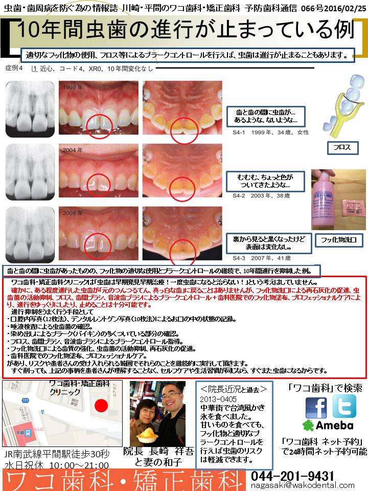 10年間虫歯の進行が止まっている例 川崎 平間のワコ歯科 矯正歯科 予防歯科通信 066号16 02 25 ワコ歯科 矯正歯科 夜時まで診療 平間駅徒歩30秒